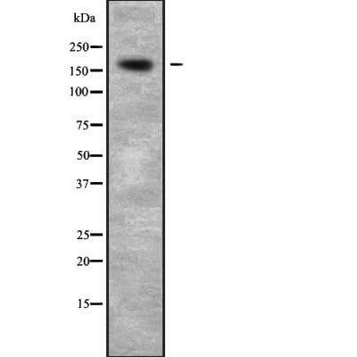 CDK12 / CRKRS Antibody
