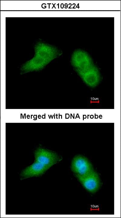 UBE2G2 Antibody (aa1-165)