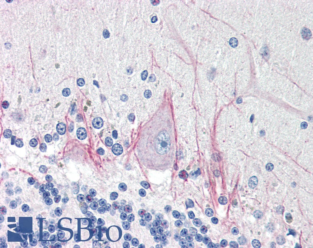 IHC-plus™ DNASE2 / DNase II Antibody