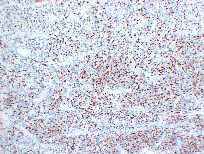 MYOG / Myogenin Antibody (clone ABT-MYOG)