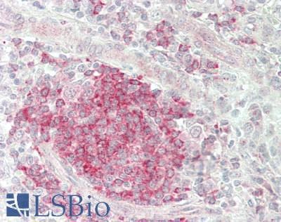 PathPlus™ ADORA2A/Adenosine A2A Receptor Antibody (Internal)