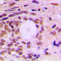 CCNF / Cyclin F Antibody (C-Terminus)