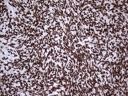 HNRNPL / hnRNP L Antibody (aa270-502, clone OTI9F11, Carrier-free)