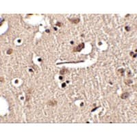 Polyclonal Rabbit anti-Human SLITRK2 Antibody (IHC, IF, WB)