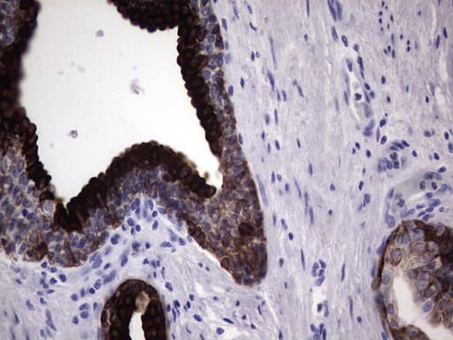 KRT19 / CK19 / Cytokeratin 19 Antibody (aa240-390, clone OTI1A8)