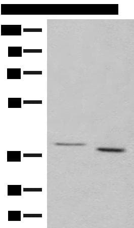 Polyclonal Rabbit anti-Human GALR1 / Galanin Receptor 1 Antibody (WB)