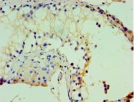 ASH2L / ASH2 Antibody (aa1-534)
