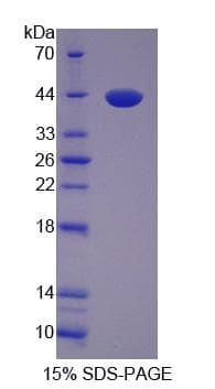 Human LDB1 / CLIM2 Protein (Recombinant His-S)