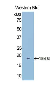 LGALS9B Antibody (aa228-355, Biotin)