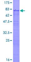 Human ZNF622 Protein (Recombinant GST)
