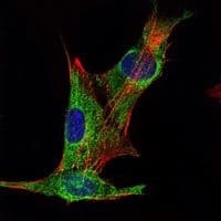 INHA / Inhibin Alpha Antibody (clone 400)
