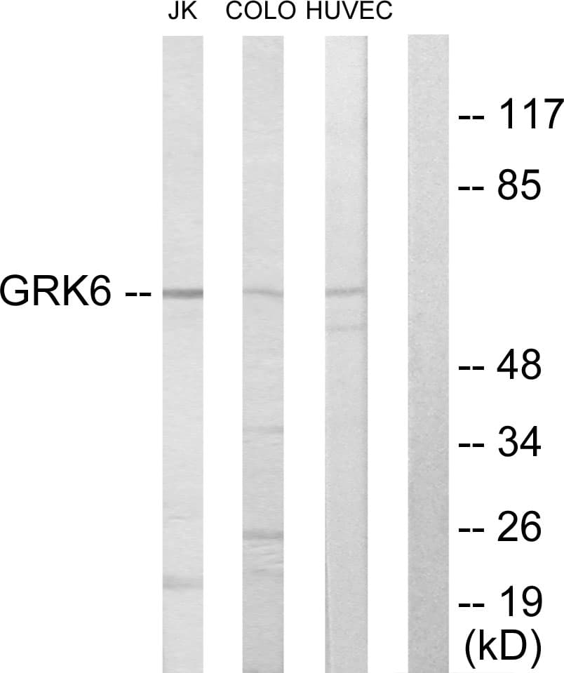 GRK6 Antibody (aa10-59)