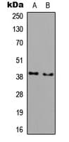 Polyclonal Rabbit anti-Human AWAT1 / DGAT2L3 Antibody (C-Terminus, WB)
