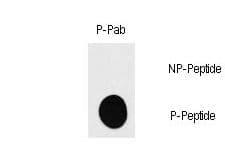 RPS6KB1 / P70S6K / S6K Antibody (phospho-Ser418)