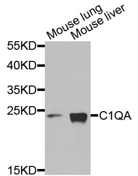IHC-plus™ Complement C1QA Antibody