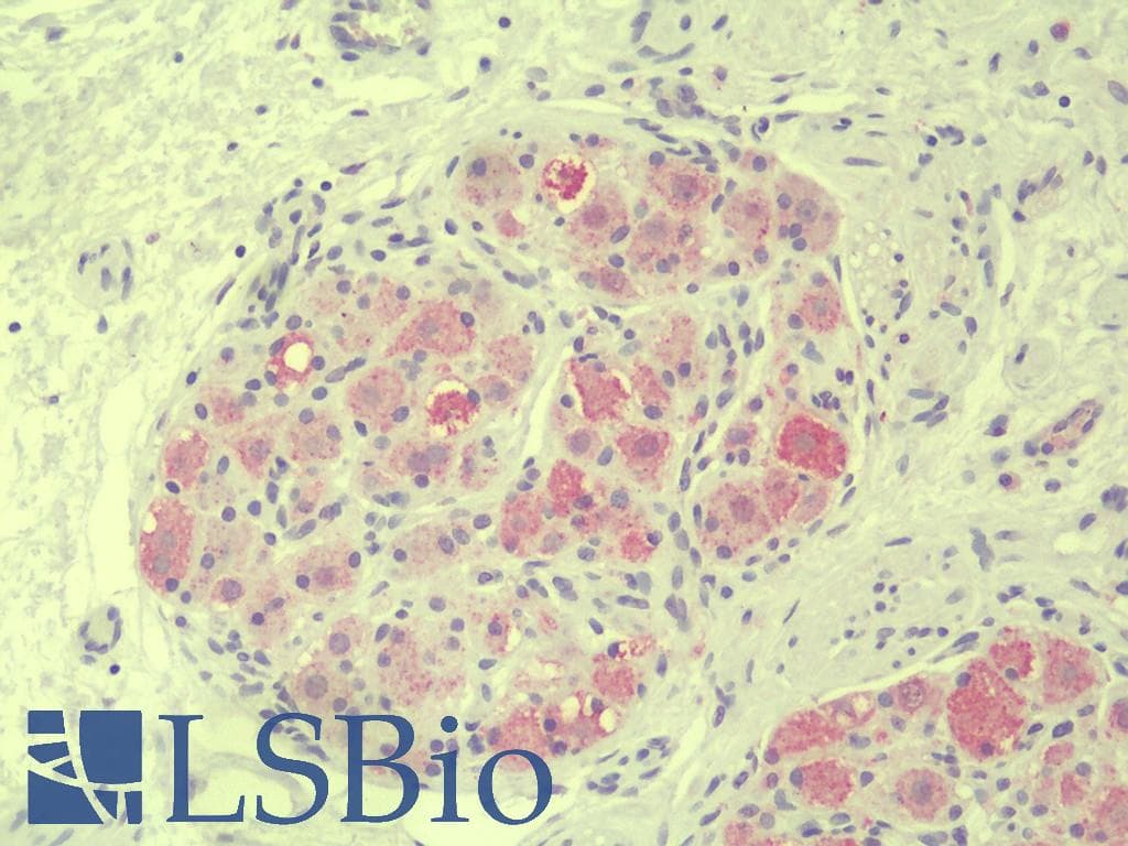 IHC-plus™ Vasohibin 1 / VASH1 Antibody