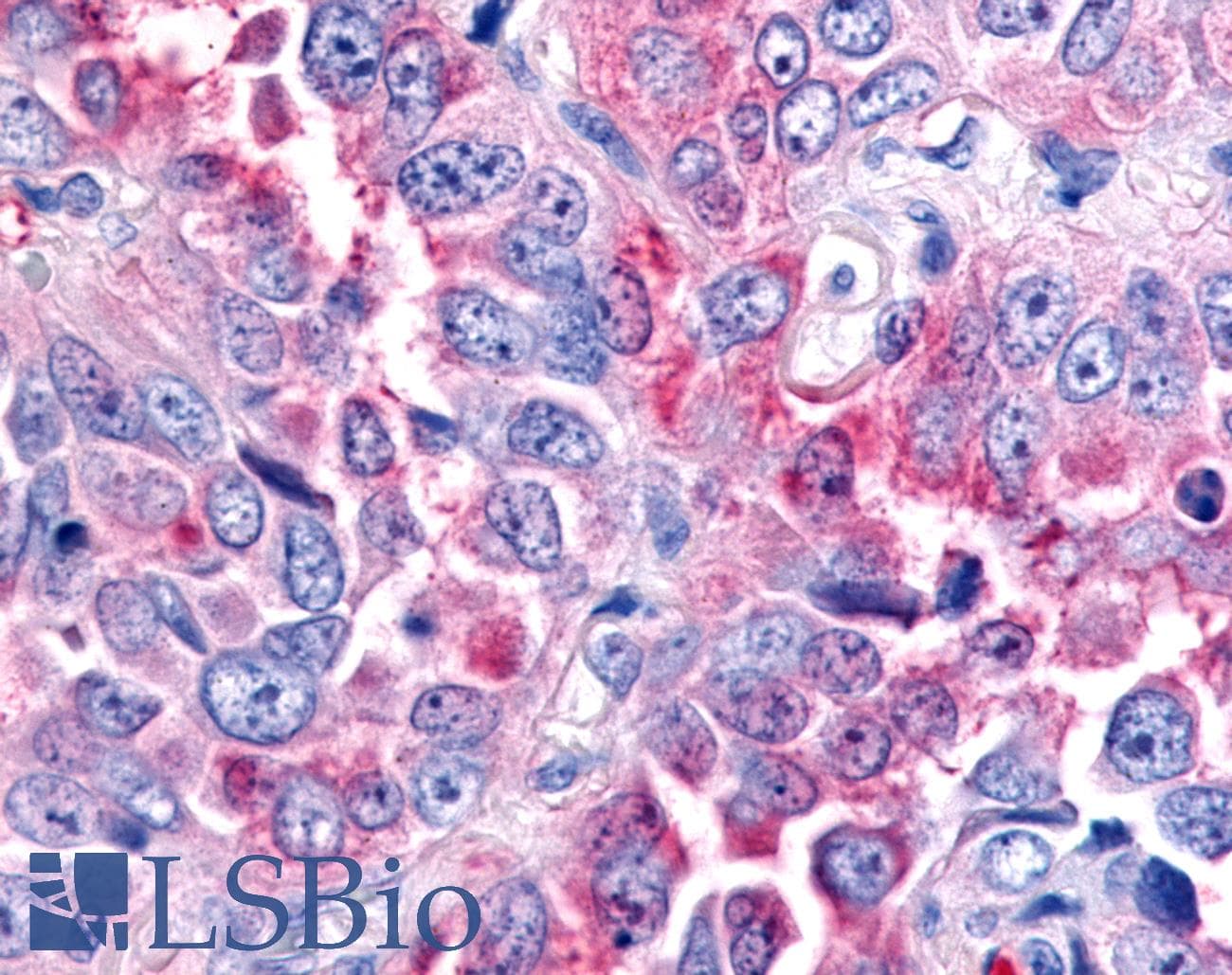 PathPlus™ MST1R / RON Antibody (C-Terminus)