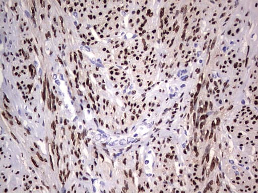 PR / Progesterone Receptor Antibody (aa1-298, clone OTI2C2)