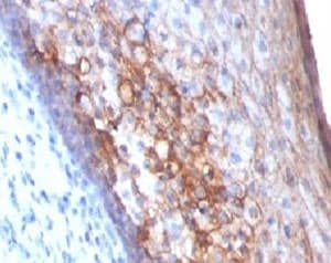 MCAM / CD146 Antibody (clone MCAM/1101)