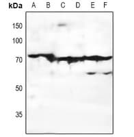 ADGRE3 / EMR3 Antibody