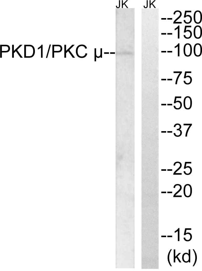 PRKD1 / PKC Mu Antibody (aa863-912)