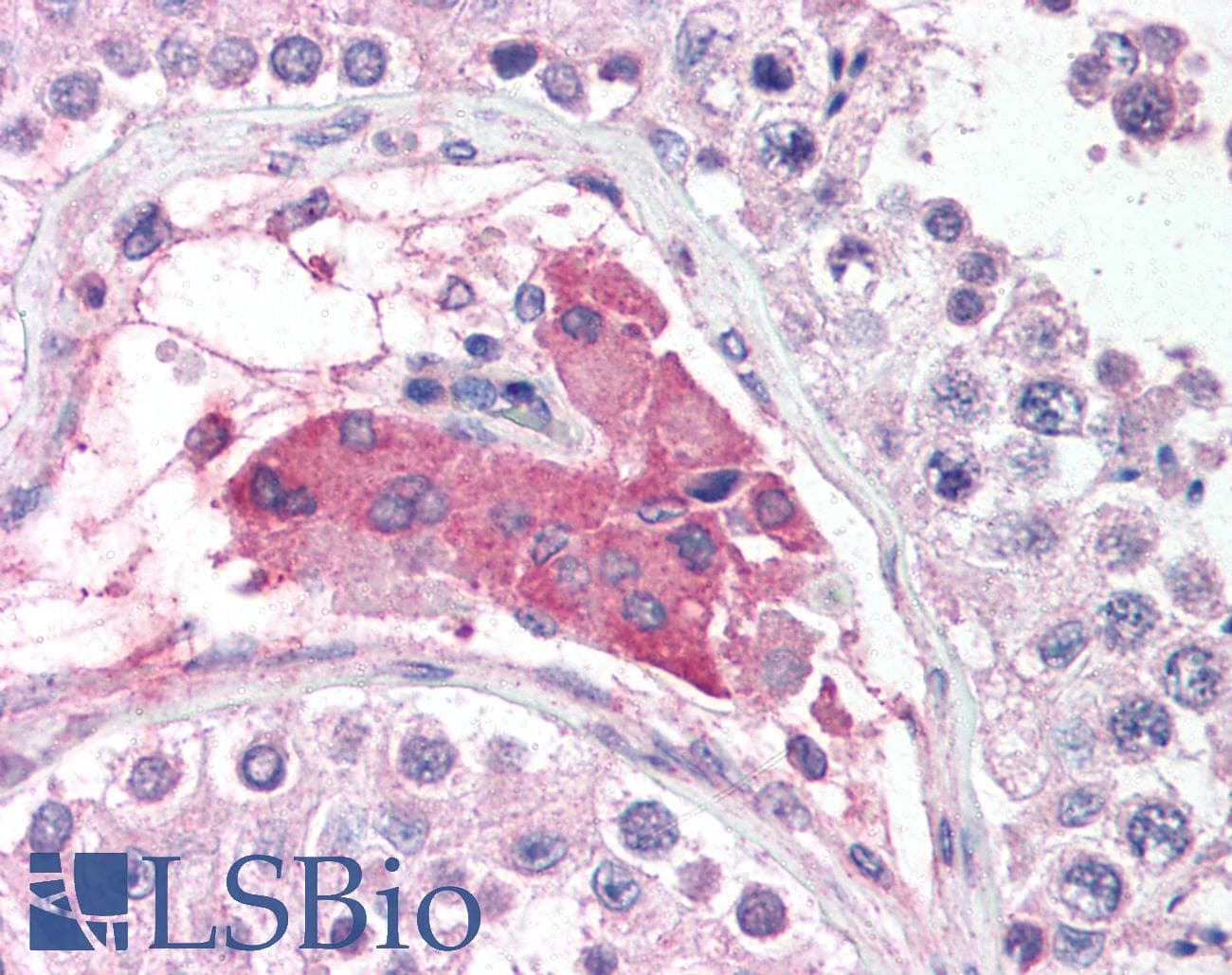 Polyclonal Rabbit anti-Human POU5F1 / OCT4 Antibody (aa114-163, IHC, WB)