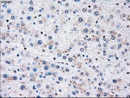 PLK1 / PLK-1 Antibody (clone OTI5C1)