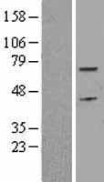 Human CDC6 Protein (Over-Expression Lysate Myc-DDK (Flag))