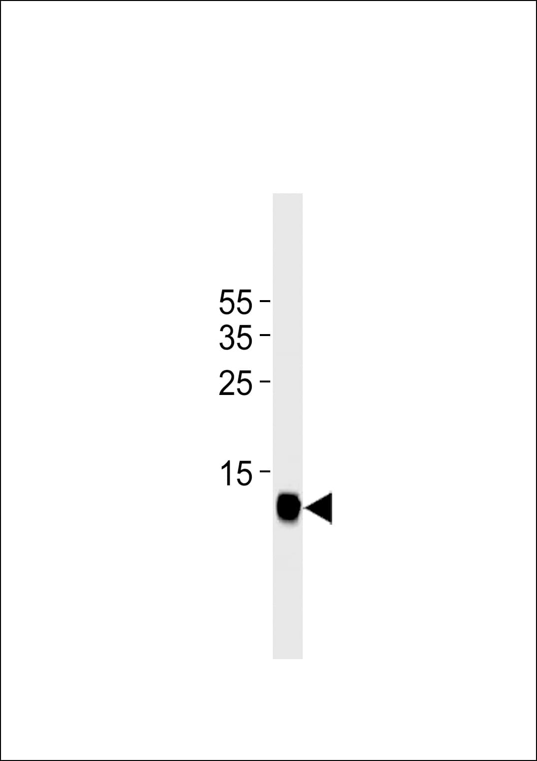 FABP3 / H-FABP Antibody (clone 883CT19.3.3)