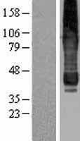 AGPAT6 Protein (Over-Expression Lysate Myc-DDK (Flag))