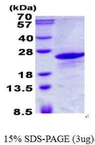 Human ICT1 / DS1 Protein (Recombinant His)