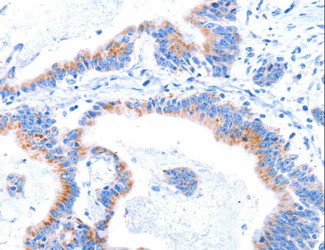 C17orf71 Antibody