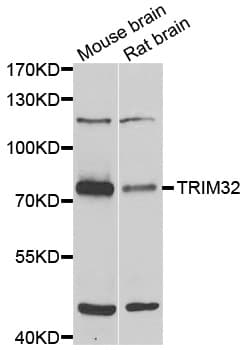 Polyclonal Rabbit anti-Human HT2A / TRIM32 Antibody (IHC, WB)