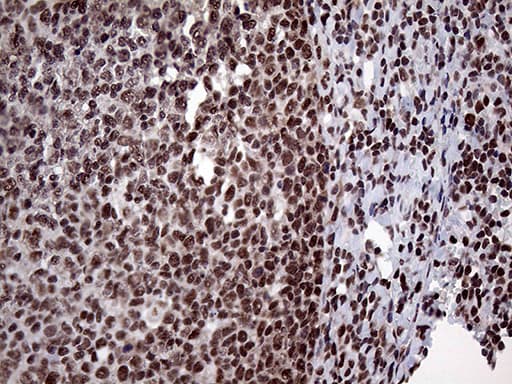 Monoclonal Mouse anti-Human PPP4C Antibody (clone OTI2E4, Carrier-free, IHC, WB)