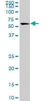 USP14 Antibody (clone 1F8)