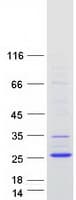 Human TMEM238 Protein (Recombinant Myc-DDK (Flag))