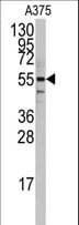 IHC-plus™ Polyclonal Rabbit anti-Human PTRF / CAVIN Antibody (aa1-30, IHC, WB)