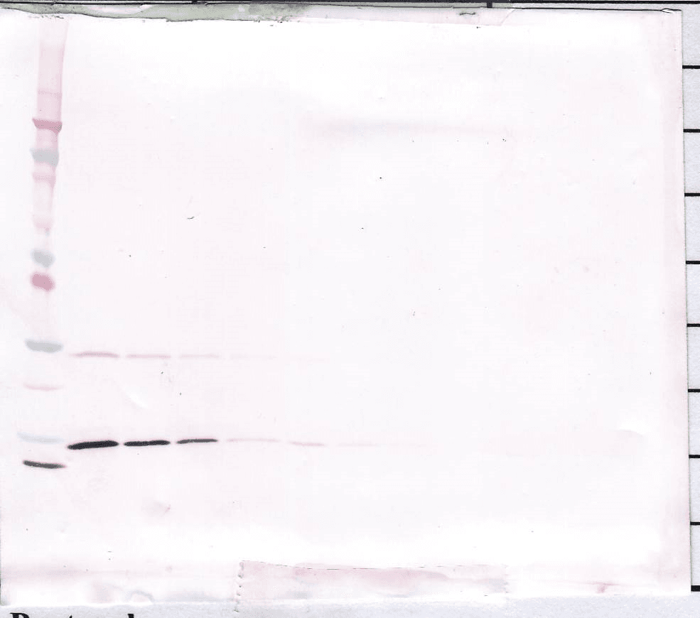 IFN Gamma / Interferon Gamma Antibody