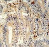 IHC-plus™ Polyclonal Rabbit anti-Human MEP1A / Meprin Alpha Antibody (aa149-175, IHC, WB)