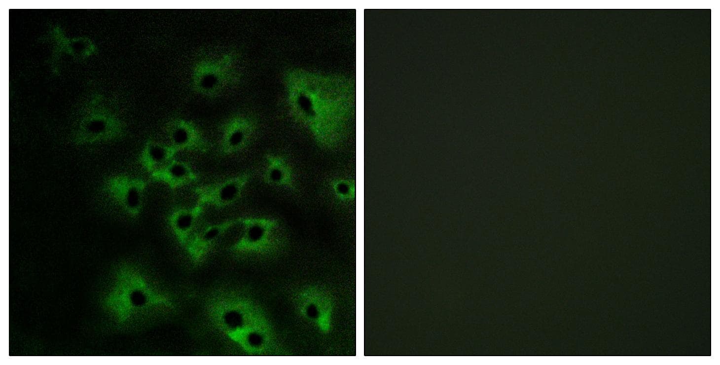 ERBB4 / HER4 Antibody (phospho-Tyr1284)
