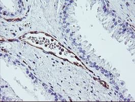 Monoclonal Mouse anti-Human DTNB / Dystrobrevin Beta Antibody (clone OTI2E6, IHC, WB)