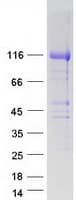 Human HEATR6 / ABC1 Protein (Recombinant Myc-DDK (Flag))