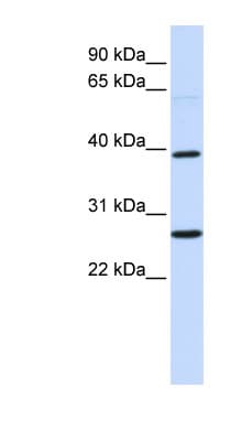 WNT16 Antibody (aa252-301)