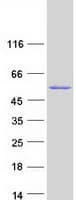 Human TBRG1 Protein (Recombinant Myc-DDK (Flag))