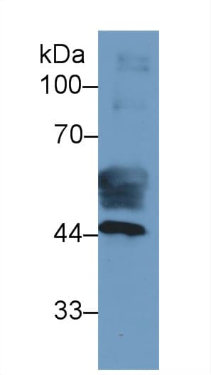 FABP3 / H-FABP Antibody (aa1-133, APC)