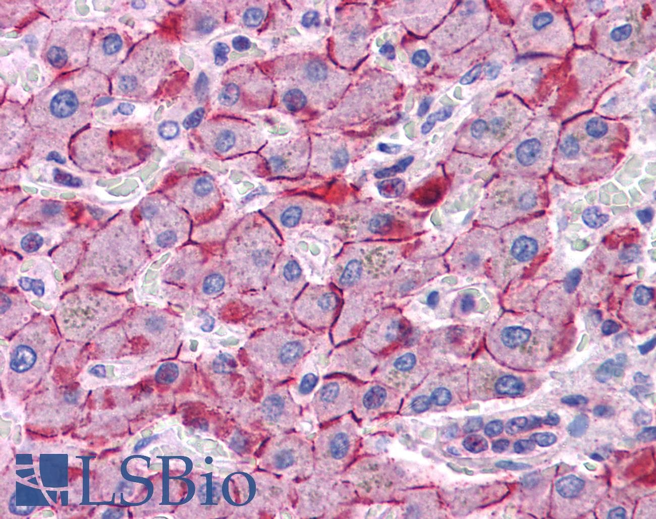 PathPlus™ Polyclonal Rabbit anti-Human CDH1 / E Cadherin Antibody (aa503-552, IHC, WB)