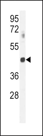GNAT2 Antibody (aa140-169)