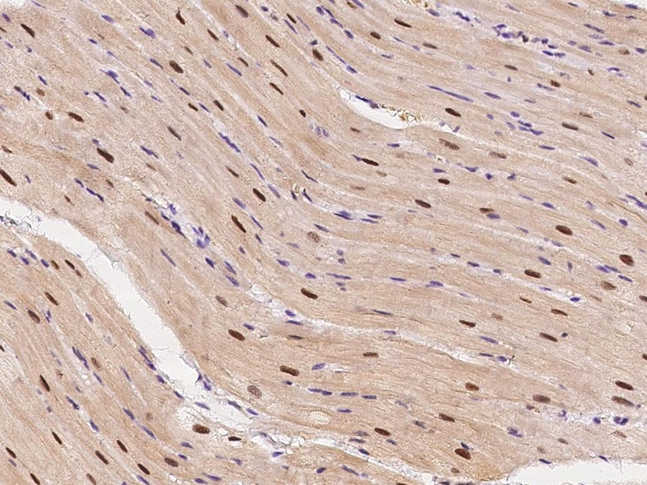 ECD Antibody (Preservative Free)