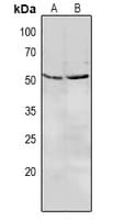 Polyclonal Rabbit anti-Human LILRA3 / CD85e Antibody (IHC, WB)