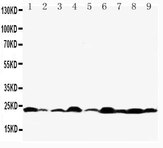 Polyclonal Rabbit anti-Human BAX Antibody (aa19-33, WB)